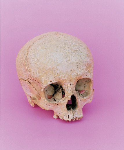 Schaedel-01-2001