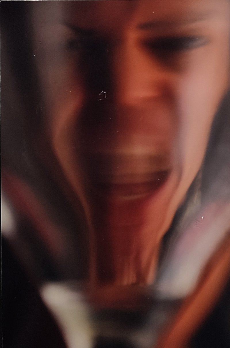 Mobina Hosseinzadeh,  Schizophrenia